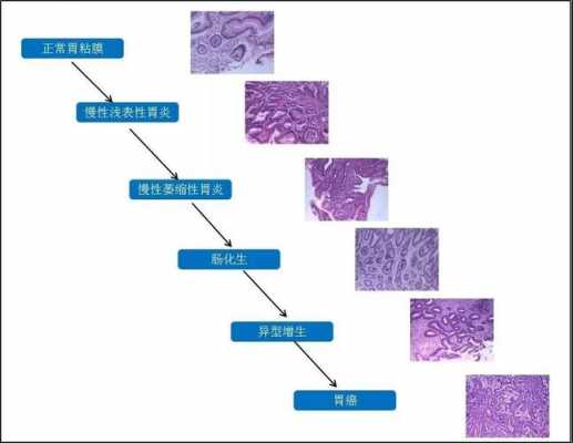 增生机化过程（增生及化生）-图1