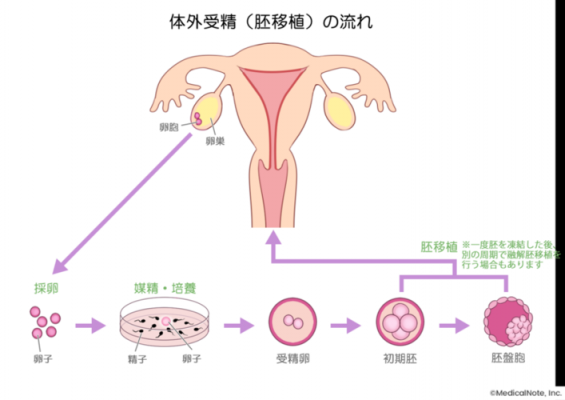 人工受精短方案过程（人工受精全过程需要多长时间）-图2