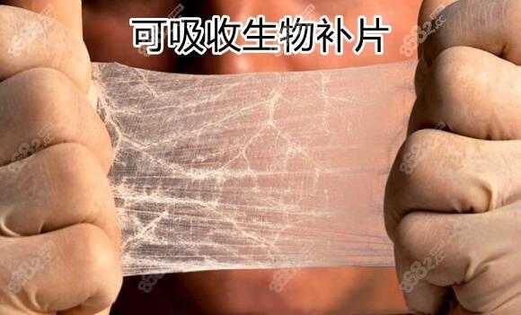 生物补片吸收过程（生物补片吸收时间）-图2