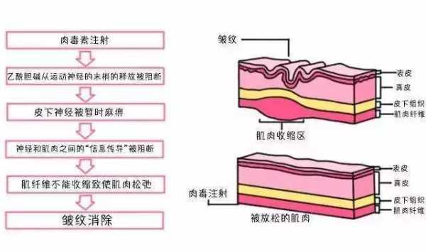 肉毒素配比过程（肉毒素注射配比方法）-图2