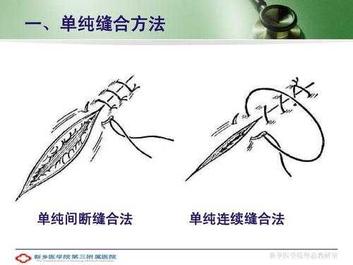 外科实验切开缝合过程（外科实验切开缝合过程图片）-图3