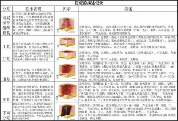 压疮的愈合过程（压疮愈合过程的护理记录）-图1