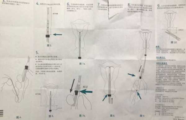 曼月乐取环全过程（曼月乐环取环好取吗）-图1