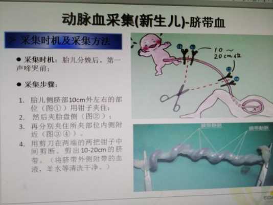 脐带血采集过程（脐带血采集有危险吗）-图2