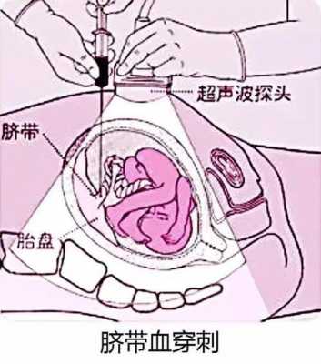 怀孕四个月引产过程（怀孕四个月引产亲身经历）-图2