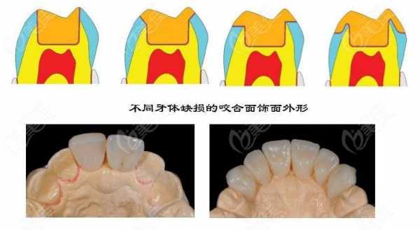 咀嚼过程磨损定义（咀嚼的基本过程）-图2