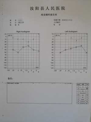 听力重建回复过程（听力重建能恢复多少听力）-图2