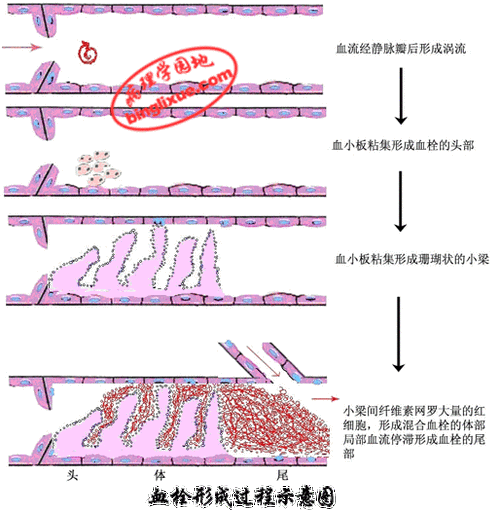 血栓的形成过程病理（血栓的形成过程病理变化）-图2