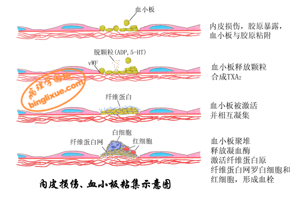 血栓的形成过程病理（血栓的形成过程病理变化）-图3