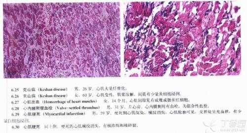 病理he染色过程（病理he染色怎么看）-图3