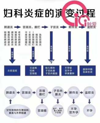 妇科蔓延过程图（妇科咋了）-图1