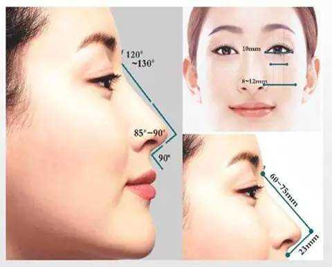 鼻梁整容过程图（鼻梁整容过程图解）-图1