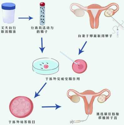 试管婴儿具体过程（试管婴儿亲身经历全详细过程）-图3