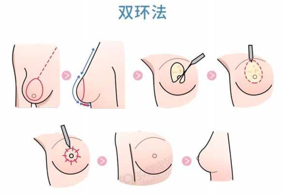 女生胸变大的过程（女生胸变大的症状）-图3