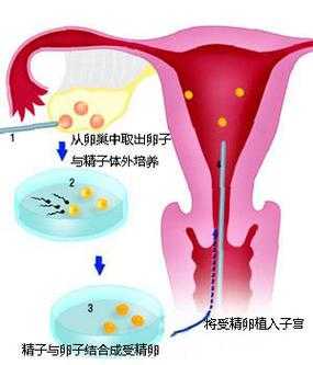 拾卵过程（输卵管拾卵过程）-图2