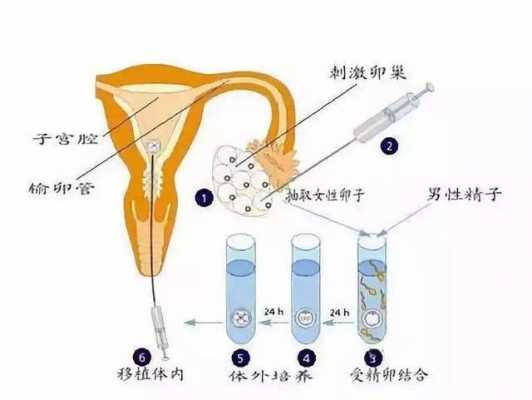 护士取卵过程（取卵是医生还是护士）-图1