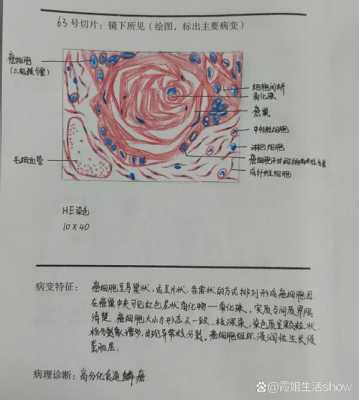 病理过程包括哪些（病理过程包括什么）-图2