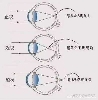 近视的原因实验过程（关于近视的实验）-图2