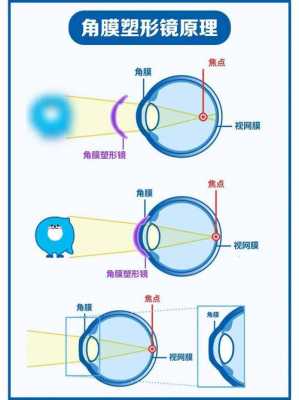 近视的原因实验过程（关于近视的实验）-图1